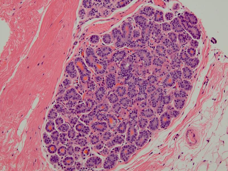 Breast Pathology | Pathology